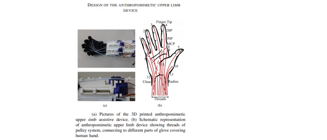 Upper limb exoskeleton-a portable anthropomimetic upper limb rehabilitation device