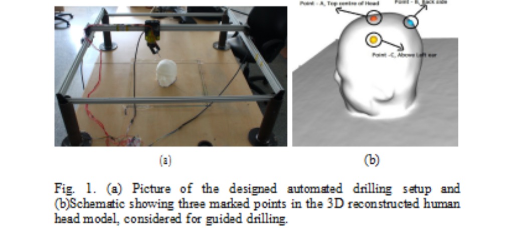 Drilling Robot -An Automated Drilling Device For Neurosurgical Applications