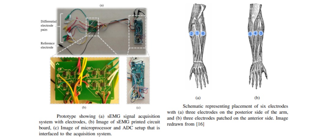 Surface-EMG system -a real time portable low-cost multi-channel surface electromyography system
